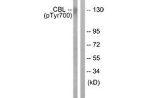 Western blot analysis of extracts from K562 cells treated with Na3VO4 0. (CBL 抗体  (pTyr700))