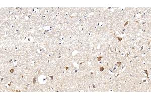 Detection of IL17RA in Human Cerebrum Tissue using Polyclonal Antibody to Interleukin 17 Receptor A (IL17RA) (IL17RA 抗体  (AA 33-172))