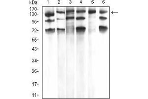 Western blot analysis using PLCG1 mouse mAb against Hela (1), A431 (2), C6 (3), NIH/3T3 (4), COS7 (5), and HCT116 (6) cell lysate.
