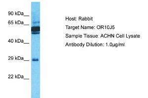 Western Blotting (WB) image for anti-Olfactory Receptor, Family 10, Subfamily J, Member 5 (OR10J5) (C-Term) antibody (ABIN2791818)