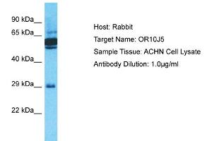 Host: Rabbit Target Name: OR10J5 Sample Type: ACHN Whole Cell lysates Antibody Dilution: 1. (OR10J5 抗体  (C-Term))