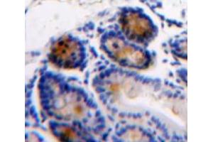 Used in DAB staining on fromalin fixed paraffin-embedded Intestine tissue (AGGF1 抗体  (AA 406-501))