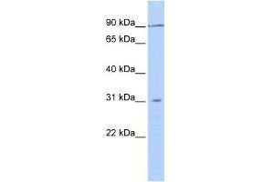 TMEM146 antibody used at 1 ug/ml to detect target protein. (TMEM146 抗体  (N-Term))