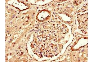 Immunohistochemistry (IHC) image for anti-Regulatory Associated Protein of mTOR, Complex 1 (RPTOR) (AA 13-128) antibody (ABIN7167652)
