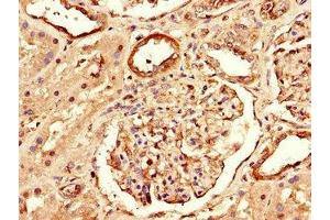 Immunohistochemistry of paraffin-embedded human kidney tissue using ABIN7167652 at dilution of 1:100 (Raptor 抗体  (AA 13-128))