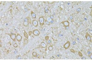 Immunohistochemistry of paraffin-embedded Mouse brain using MTNR1A Polyclonal Antibody at dilution of 1:100 (40x lens). (Melatonin Receptor 1A 抗体)