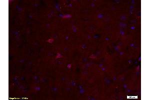 Formalin-fixed and paraffin embedded rat brain labeled with Anti-S100B Polyclonal Antibody, Unconjugated (ABIN676703) at 1:200 followed by conjugation to the secondary antibody and DAB staining. (S100B 抗体  (AA 31-92))