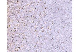 IHC analysis of CLASP1 using anti-CLASP1 antibody (ABIN7599144). (CLASP1 抗体  (AA 1-243))