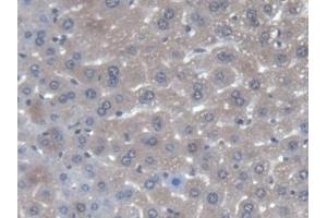 DAB staining on IHC-P; Samples: Mouse Liver Tissue (AGXT 抗体  (AA 120-334))
