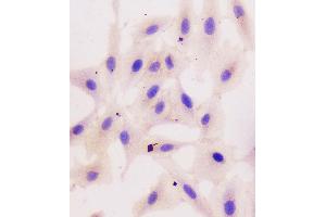 IHC analysis of beta Catenin using anti-beta Catenin antibody (ABIN5693091).