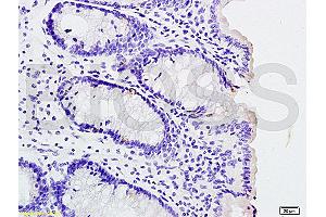 Formalin-fixed and paraffin embedded rat colitis labeled with Rabbit Anti phospho-IL-1R1(Tyr496) Polyclonal Antibody, Unconjugated (ABIN801423) at 1:200 followed by conjugation to the secondary antibody and DAB staining (IL1R1 抗体  (pTyr496))