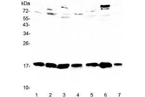 Western blot testing of 1) rat testis, 2) rat brain, 3) rat thymus, 4) mouse testis, 5) mouse brain, 6) mouse thymus and 7) mouse HEPA1-6 lysate with WFDC2 antibody at 0. (WFDC2 抗体)