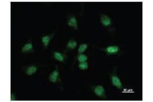 Immunostaining analysis in HeLa cells. (BBX 抗体)