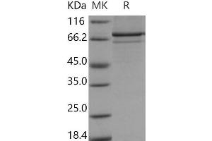 Western Blotting (WB) image for Mitogen-Activated Protein Kinase-Activated Protein Kinase 5 (MAPKAPK5) protein (GST tag,His tag) (ABIN7317049) (MAPKAP Kinase 5 Protein (GST tag,His tag))
