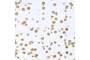 Immunohistochemistry (Paraffin-embedded Sections) (IHC (p)) image for anti-KH Domain Containing, RNA Binding, Signal Transduction Associated 1 (KHDRBS1) (C-Term) antibody (ABIN6142829)