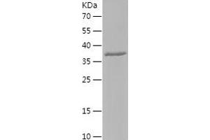 HYAL2 Protein (AA 295-448) (His-IF2DI Tag)