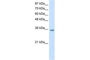 Western Blotting (WB) image for anti-Homeobox D4 (HOXD4) antibody (ABIN2461853) (HOXD4 抗体)