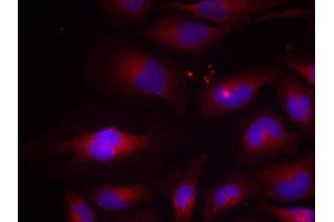 Immunofluorescence (IF) image for anti-Nuclear Factor of kappa Light Polypeptide Gene Enhancer in B-Cells 2 (NFKB2) (pSer870) antibody (ABIN1870475) (NFKB2 抗体  (pSer870))