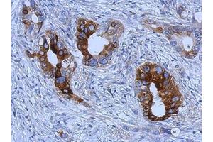 Image no. 1 for anti-Trefoil Factor 1 (TFF1) (AA 1-84) antibody (ABIN1501358) (TFF1 抗体  (AA 1-84))