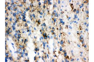 Anti-GAP43 antibody, IHC(P) IHC(P): Human Glioma Tissue (GAP43 抗体  (C-Term))