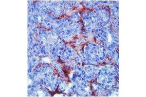 Immunohistochemistry (IHC) image for anti-Matrix Metallopeptidase 9 (Gelatinase B, 92kDa Gelatinase, 92kDa Type IV Collagenase) (MMP9) (N-Term) antibody (ABIN2777743)