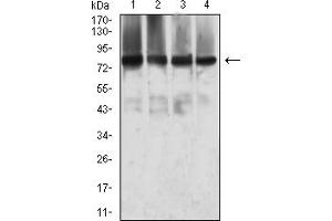 Western Blotting (WB) image for anti-Metastasis Associated 1 (MTA1) (AA 541-715) antibody (ABIN7193370)