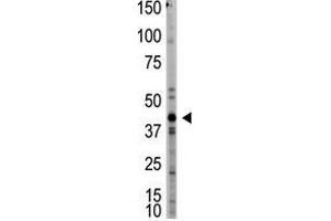 Image no. 1 for anti-Myostatin (MSTN) (N-Term) antibody (ABIN357462) (MSTN 抗体  (N-Term))