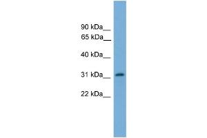 WB Suggested Anti-PIGL  Antibody Titration: 0. (PIGL 抗体  (N-Term))