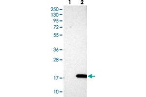 Western blot analysis of Lane 1: Negative control (vector only transfected HEK293T lysate), Lane 2: Over-expression Lysate (Co-expressed with a C-terminal myc-DDK tag (~3. (PHLDA3 抗体)