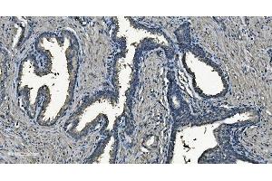 IHC analysis of NDUFB5 using anti-NDUFB5 antibody (ABIN7601297).