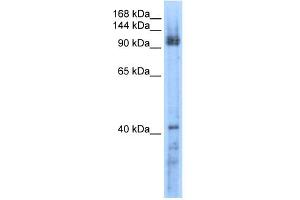 RecQL5 antibody used at 0. (RECQL5 抗体  (Middle Region))