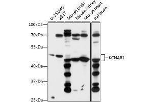 Western blot analysis of extracts of various cell lines, using KCN antibody (ABIN7269480) at 1:1000 dilution. (KCNAB1 抗体  (AA 282-401))