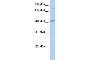 Western Blotting (WB) image for anti-SRY (Sex Determining Region Y)-Box 4 (SOX4) (N-Term) antibody (ABIN2780469)
