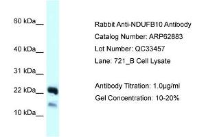Western Blotting (WB) image for anti-NADH Dehydrogenase (Ubiquinone) 1 beta Subcomplex, 10, 22kDa (NDUFB10) (C-Term) antibody (ABIN2789283)