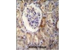 NR3C1 Antibody (C-term) B immunohistochemistry analysis in formalin fixed and paraffin embedded human kidney tissue followed by peroxidase conjugation of the secondary antibody and DAB staining. (Glucocorticoid Receptor 抗体  (C-Term))