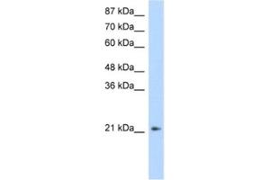 Western Blotting (WB) image for anti-Fer3-Like (FERD3L) antibody (ABIN2461316) (FERD3L 抗体)