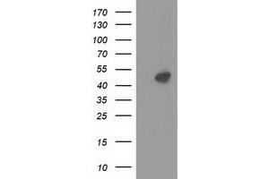 Western Blotting (WB) image for anti-Protein Kinase, CAMP-Dependent, Regulatory, Type II, alpha (PRKAR2A) antibody (ABIN1500254) (PRKAR2A 抗体)