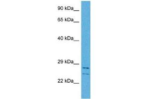 Host:  Rabbit  Target Name:  CSRP3  Sample Tissue:  Human HCT116 Whole Cell  Antibody Dilution:  1ug/ml (CSRP3 抗体  (Middle Region))