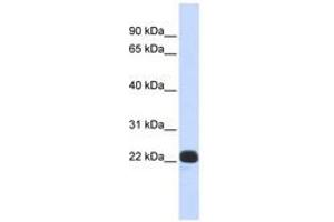 Image no. 1 for anti-Recoverin (RCVRN) (N-Term) antibody (ABIN6740369) (Recoverin 抗体  (N-Term))