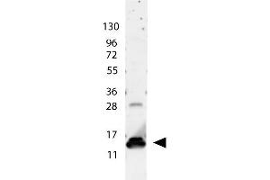 anti-Human IL-9 antibody shows detection of a band ~15 kDa in size corresponding to recombinant human IL-9. (IL-9 抗体)