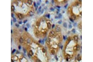 Used in DAB staining on fromalin fixed paraffin-embedded Kidney tissue (PARK7/DJ1 抗体  (AA 1-189))