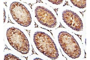 IHC analysis of CRB1 using anti-CRB1 antibody (ABIN6719658).