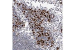 Immunohistochemical staining of human lymph node with TMEM69 polyclonal antibody  shows strong cytoplasmic positivity in lymphoid cells outside reaction centra at 1:20-1:50 dilution. (TMEM69 抗体)
