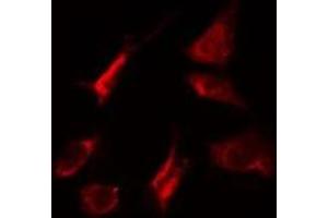 ABIN6275267 staining HeLa cells by IF/ICC. (MYO5A 抗体  (C-Term))