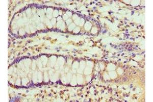 Immunohistochemistry of paraffin-embedded human colon tissue using ABIN7151115 at dilution of 1:100 (RBX1 抗体  (AA 1-108))