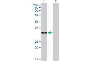 Western Blot analysis of SSR1 expression in transfected 293T cell line by SSR1 monoclonal antibody (M02), clone 1C11. (SSR1 抗体  (AA 33-286))