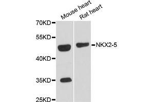Western blot analysis of extracts of various cell lines, using NKX2-5 antibody (ABIN6293408) at 1:3000 dilution. (NK2 Homeobox 5 抗体)