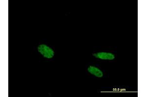 Immunofluorescence of purified MaxPab antibody to VDR on HeLa cell. (Vitamin D Receptor 抗体  (AA 1-427))