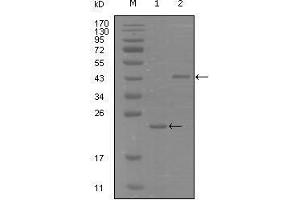 Western blot analysis using EphA8 mouse mAb against truncated Trx-EphA8 recombinant protein (1) and truncated MBP-EphA8(aa70-150) recombinant protein (2). (EPH Receptor A8 抗体  (AA 70-150))