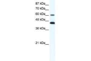 WB Suggested Anti-ANXA6 Antibody Titration:  1. (ANXA6 抗体  (N-Term))